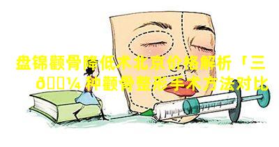 盘锦颧骨降低术北京价格解析「三 🐼 种颧骨整形手术方法对比 🌴 」